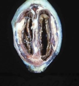 Damage caused by stink bug and leaffooted bug feeding. Black pit caused by pre-hardening feeding. (Photo by Louis Tedders)